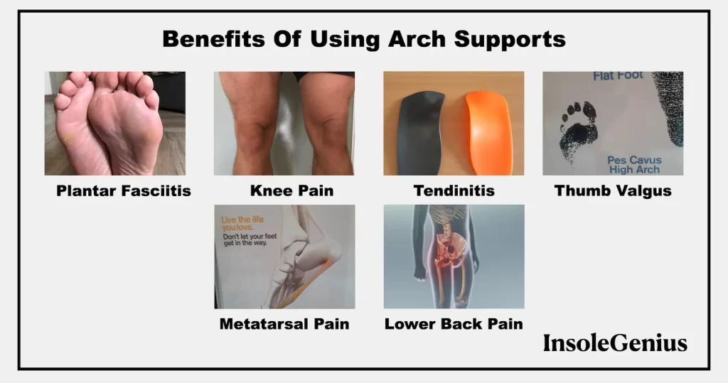 good feet store arch support health benefits